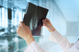 A medical professional holds up a medical image and studies the photo.