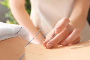 An acupuncturist is shown giving a holistic treatment.